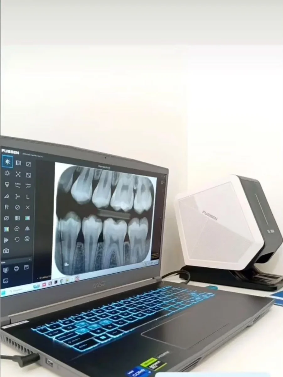 اسکنر فسفرپلیت فیوژن FUSSEN مدل F220 — تصویر ۲