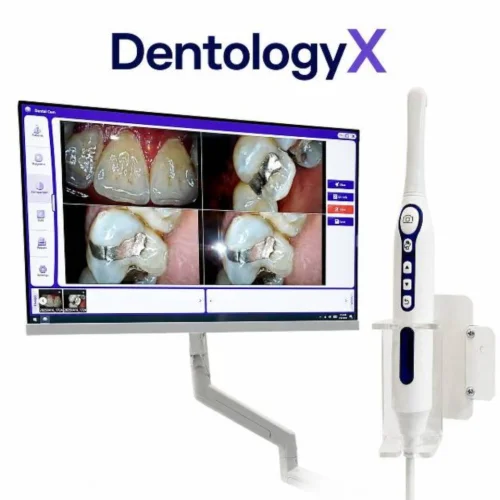 دوربین داخل دهانی All in One DentologyX