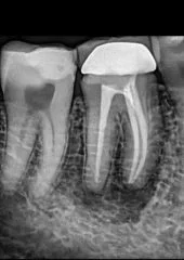 رادیوگرافی پرتابل مدل: UA-DENTAL — تصویر ۲
