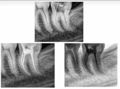 رادیوگرافی پرتابل مدل: UA-DENTAL — تصویر ۳