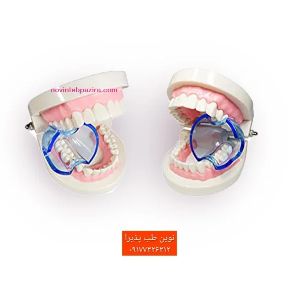 دهان بازکن خلفی (toothis (posterior — تصویر ۳