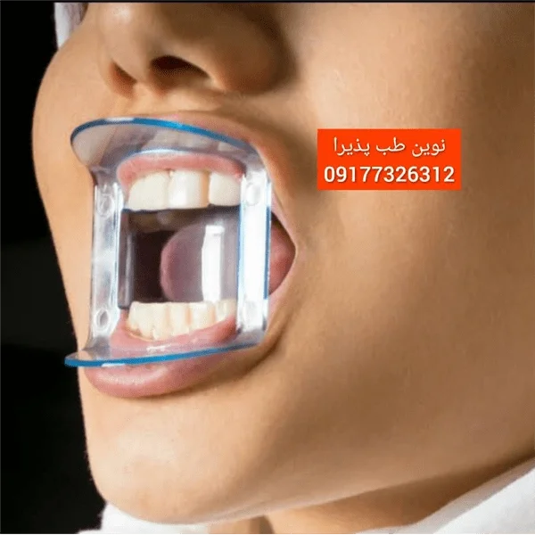 دهان بازکن قدامی Anterior — تصویر ۲