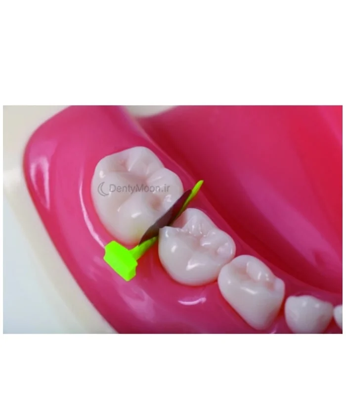 فندرمیت پرایم دایرکتا Directa FenderMate Prime — تصویر ۲
