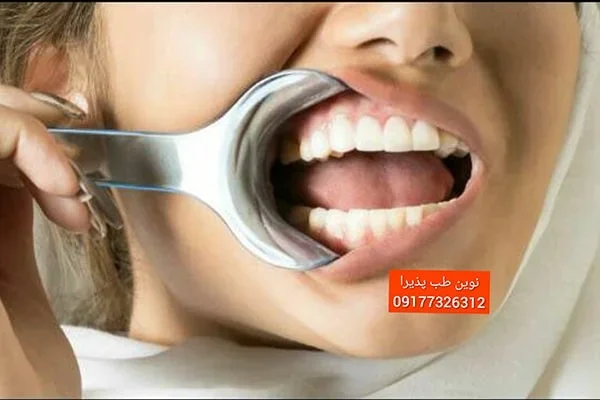 دهان بازکن یکطرفه اطفال ماکوئرا Maquira — تصویر ۲