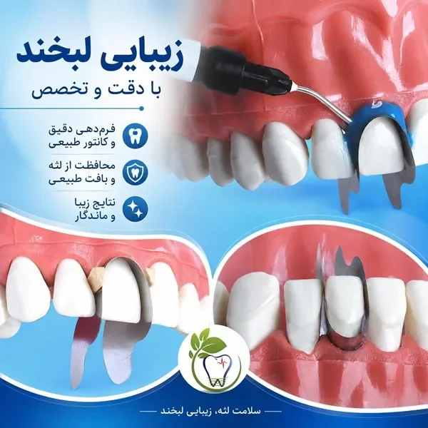 نوار ماتریکس امگا Zakmoris Omega — تصویر ۲