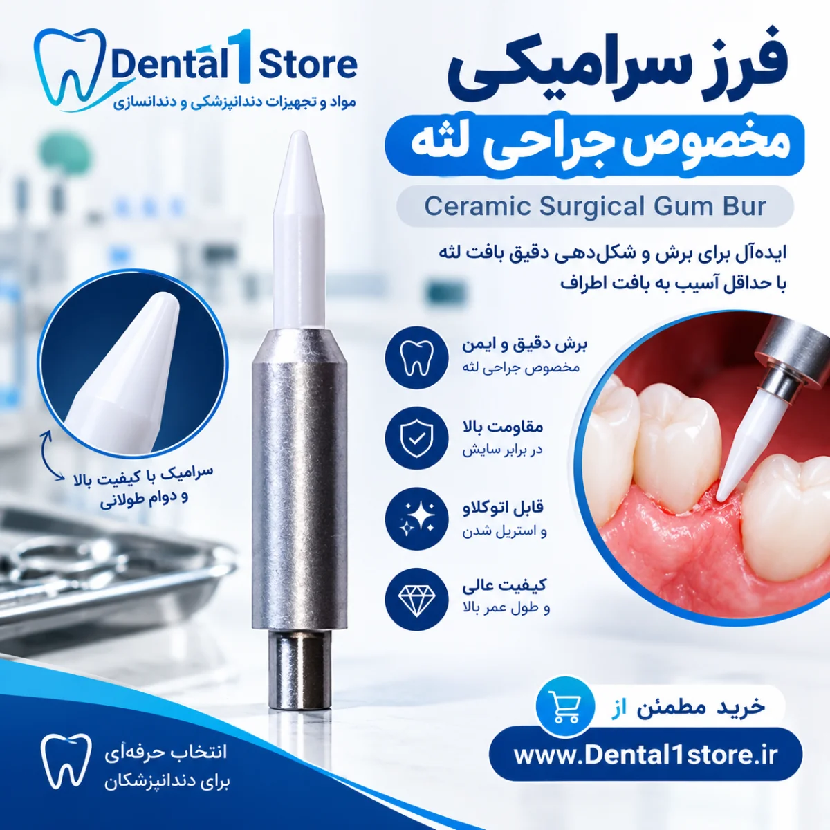 فرز سرامیکی