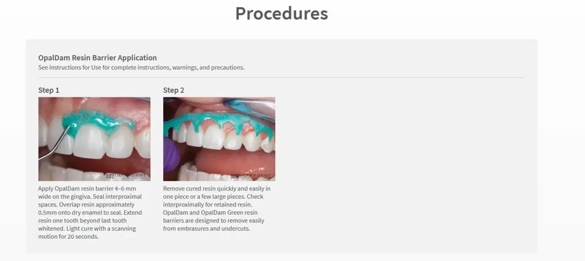 رزین رابردم اوپال دم الترادنت Ultradent OpalDam — تصویر ۲