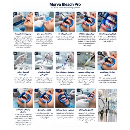 کیت بلیچینگ آفیس پرو مروابن Morva Bleach Office Pro Kit