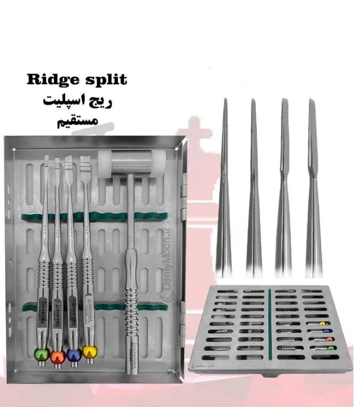 کیت ریج اسپلیت کاریزما Charisma