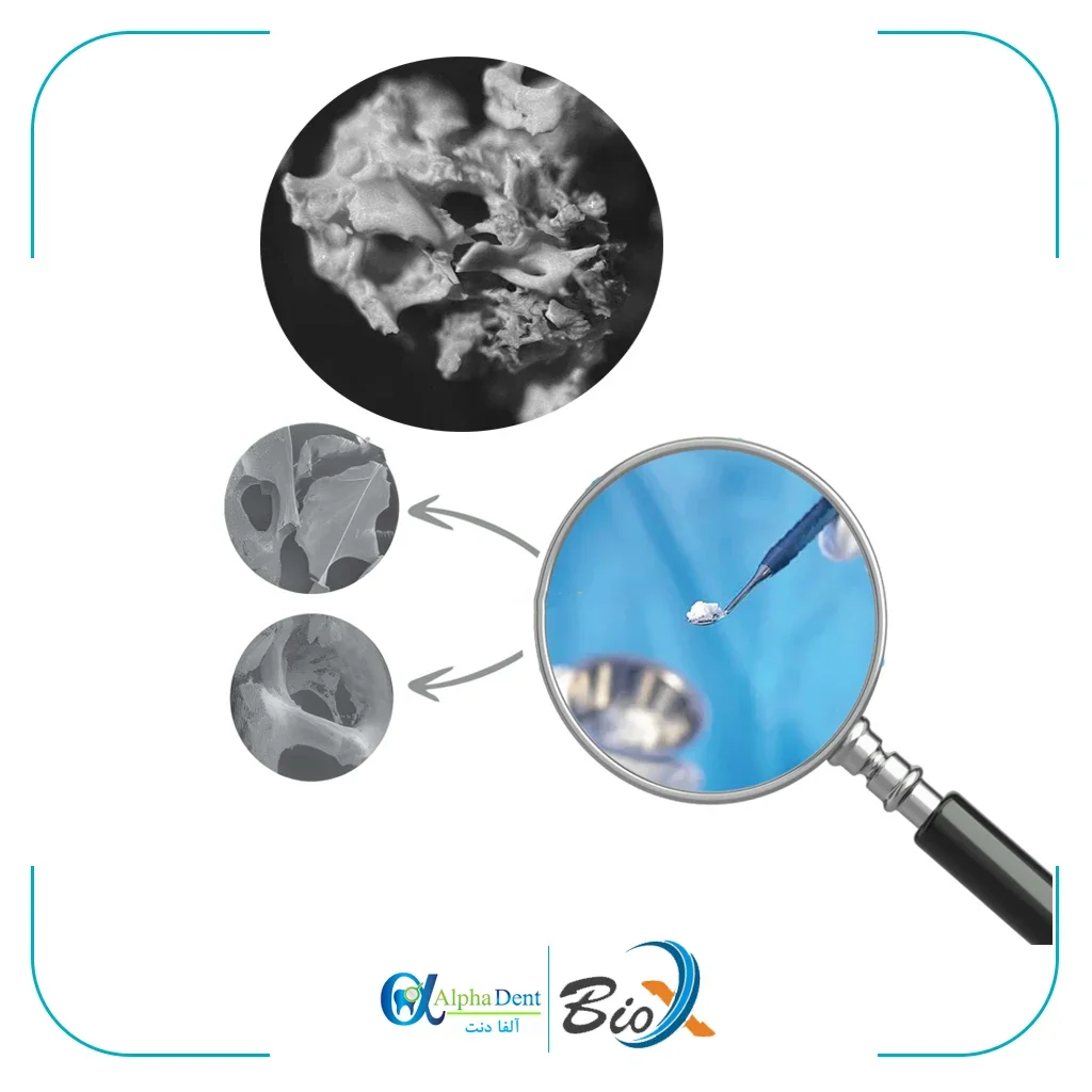 پودر استخوان بایوایکس BioX — تصویر ۳